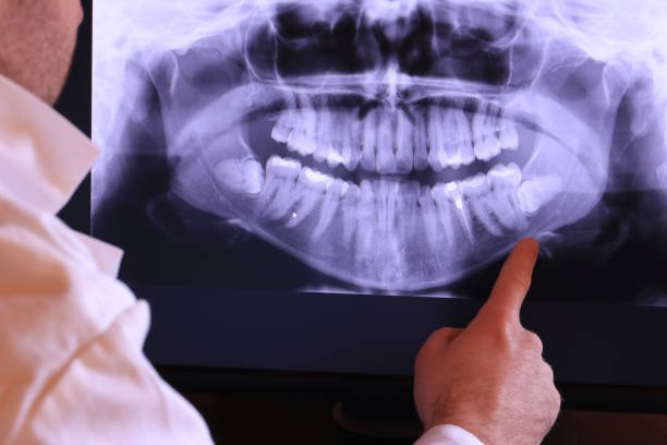 Best Emergency Treatment for Toothache in Blanchard, OK